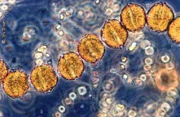 Microalga causante de la marea roja aumenta en intensidad y extensión